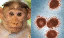 美国猴痘爆料新闻视频大全,视频大全揭秘病毒传播与应对措施